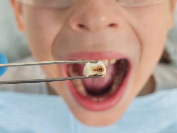  , DC Emergency Dentist Pros