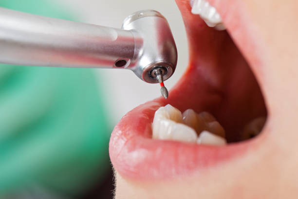 Best Emergency Dental Care for Sports Injuries in , DC